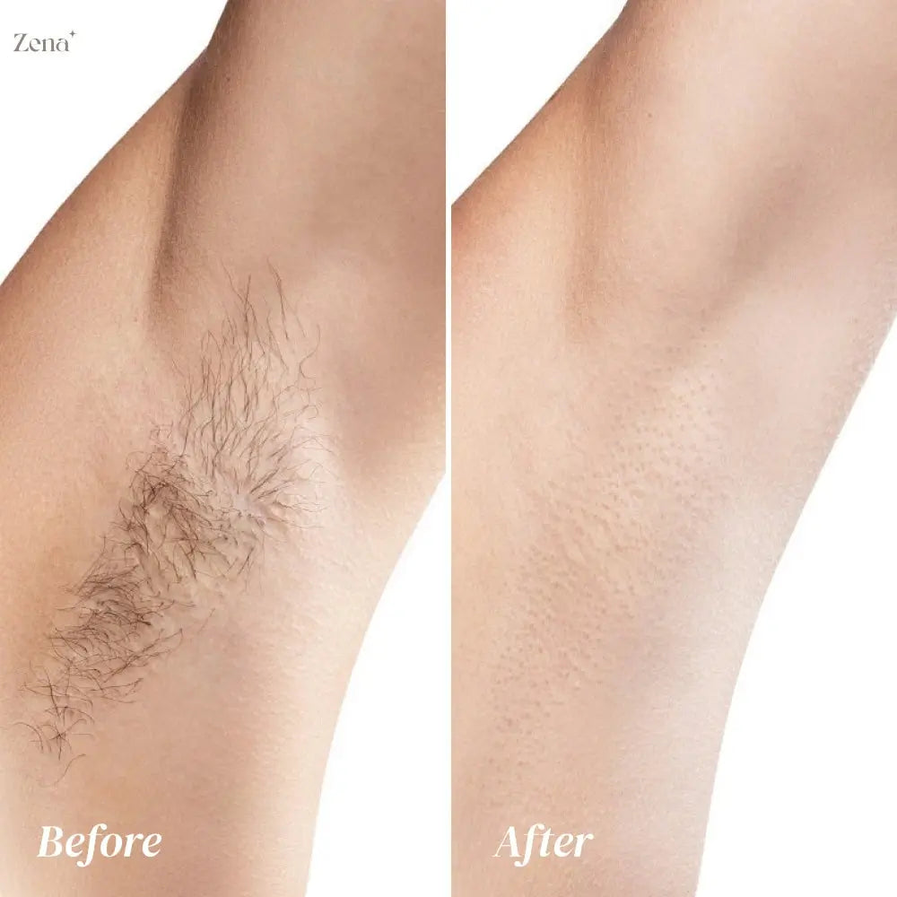 Painless Hair Removal Cream for Body ZenaMakeup