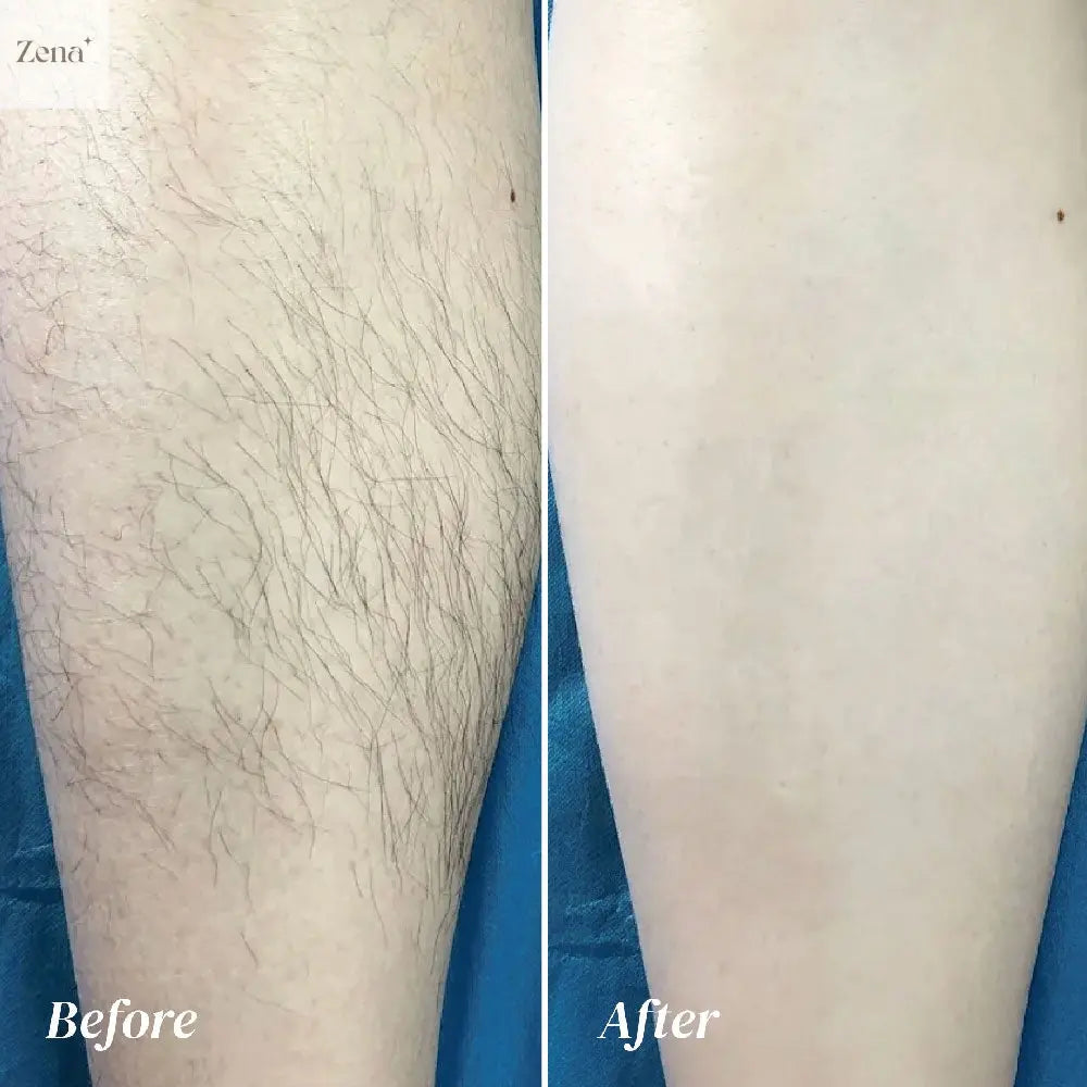 Painless Hair Removal Cream for Body ZenaMakeup