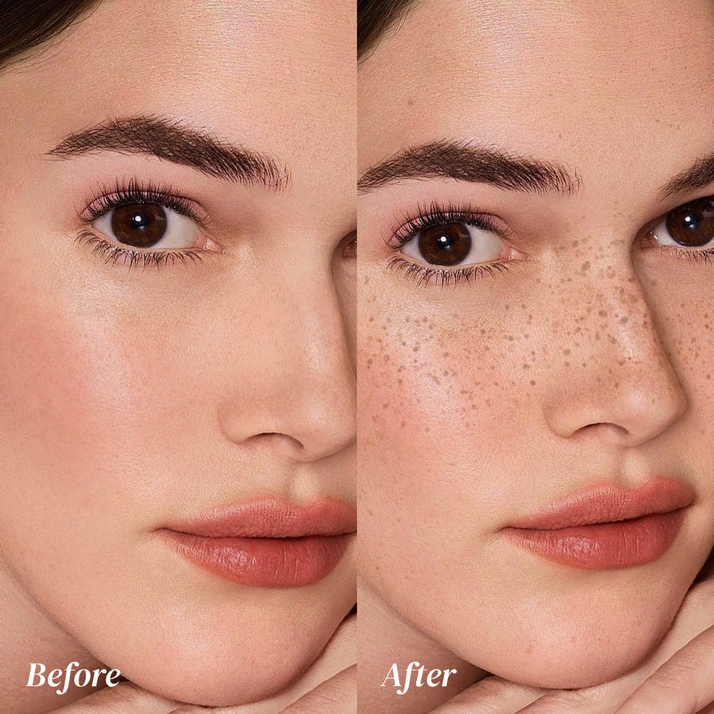 Before and after comparison of a woman's face with visible freckles.
